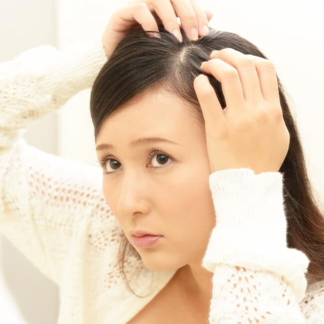 白髪悩み